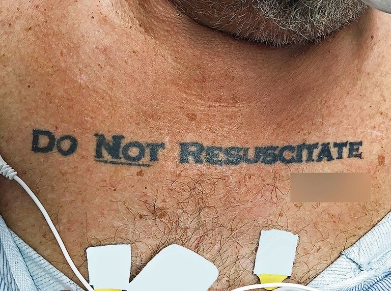 A Do Not Resuscitate tattoo on an individual's chest.